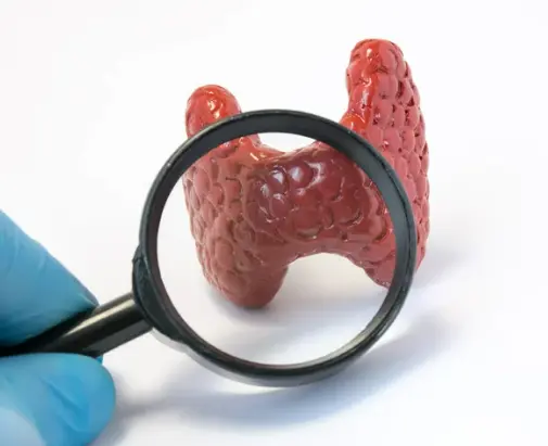 고양이 갑상선 기능 항진증 원인, 증상, 수치 및 관리법 총정리