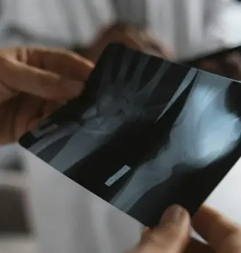 강아지 절뚝거림 슬개골 탈구 500만 원 수술비 막는 예방법