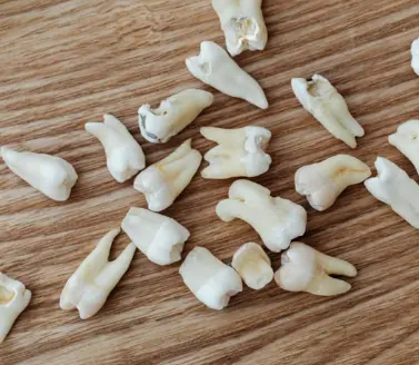 고양이 잇몸 부음 치은염 원인 증상 및 치료 후기