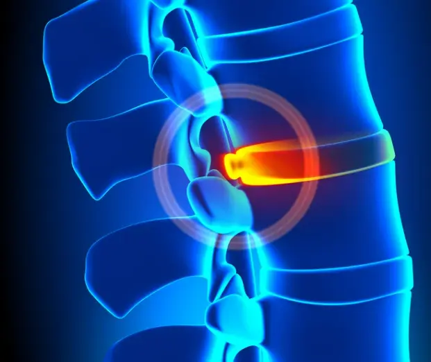 강아지 디스크, 수술만 답일까? 초기 증상·관리·예방법 총정리