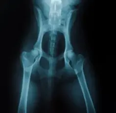 강아지 고관절 이형성증 원인, 예방법 수술 전 확인